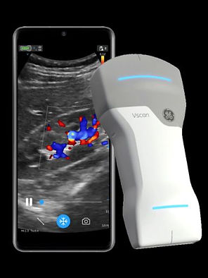 GE Vscan Air Ultrasound Machine | Standard Ultrasound